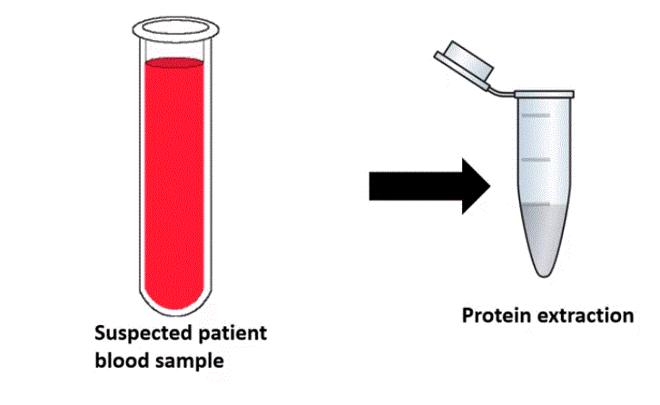 Serum sample